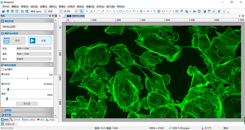 MINGHUI顯微鏡相機(jī)軟件-廣州明慧