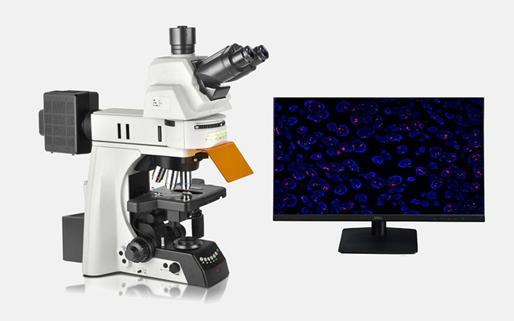 正置熒光顯微鏡、生物熒光顯微鏡、廣州明慧顯微鏡