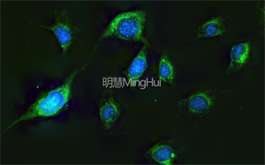 明慧的三色LED倒置熒光顯微鏡MHIF2000和高清顯微鏡攝像頭MHS900的結合，助力南科醫(yī)學大學進行細胞多色熒光觀察。