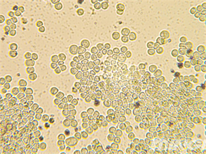 倒置生物顯微鏡MHIL150+相機(jī)MHD800應(yīng)用于細(xì)胞觀察-廣州市明慧科技有限公司